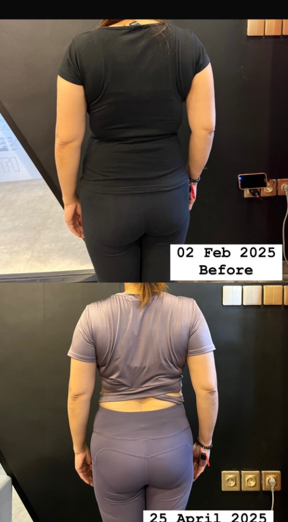 Postural training before and after
